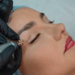 خرید قلم دستگاه پلاسما پن فیوژن PAA