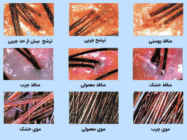 دستگاه آنالیزور پوست کلین