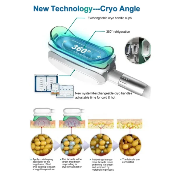 دستگاه لاغری کرایولیپولیز 360 درجه مایناطب
